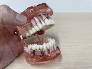 歯の残存数２